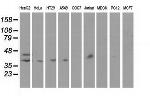 HP Antibody in Western Blot (WB)