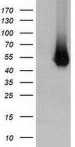 HP Antibody in Western Blot (WB)