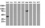 HP Antibody in Western Blot (WB)