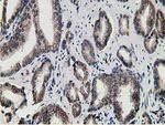 HPGD Antibody in Immunohistochemistry (Paraffin) (IHC (P))