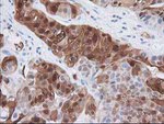 HPGD Antibody in Immunohistochemistry (Paraffin) (IHC (P))