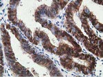 HPGD Antibody in Immunohistochemistry (Paraffin) (IHC (P))