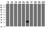 HPGD Antibody in Western Blot (WB)