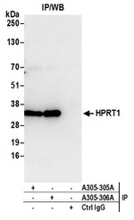 HPRT1 Antibody in Western Blot (WB)