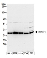 HPRT1 Antibody in Western Blot (WB)