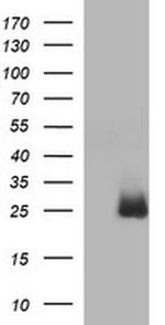 HPRT1 Antibody in Western Blot (WB)