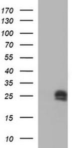 HPRT1 Antibody in Western Blot (WB)