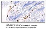 Helicobacter pylori Antibody in Immunohistochemistry (IHC)