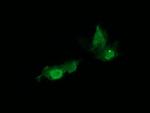 HRAS Antibody in Immunocytochemistry (ICC/IF)