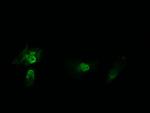 HRAS Antibody in Immunocytochemistry (ICC/IF)