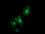 HRAS Antibody in Immunocytochemistry (ICC/IF)