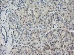 HRAS Antibody in Immunohistochemistry (Paraffin) (IHC (P))