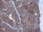 HRAS Antibody in Immunohistochemistry (Paraffin) (IHC (P))