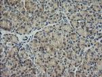 HRAS Antibody in Immunohistochemistry (Paraffin) (IHC (P))