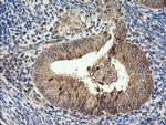 HRAS Antibody in Immunohistochemistry (Paraffin) (IHC (P))