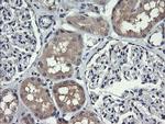 HRAS Antibody in Immunohistochemistry (Paraffin) (IHC (P))