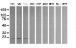 HRAS Antibody in Western Blot (WB)