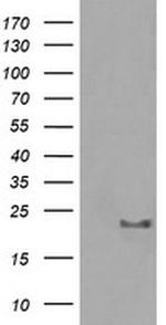 HRAS Antibody in Western Blot (WB)