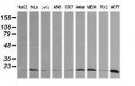 HRAS Antibody in Western Blot (WB)