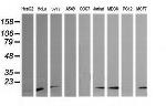 HRAS Antibody in Western Blot (WB)