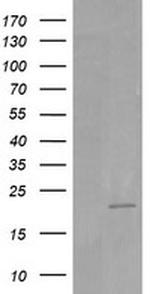 HRAS Antibody in Western Blot (WB)