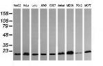 HRAS Antibody in Western Blot (WB)