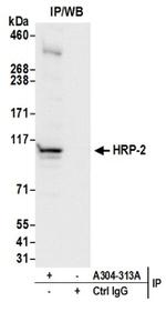 HRP-2 Antibody in Immunoprecipitation (IP)