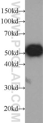 GFP tag Antibody in Western Blot (WB)