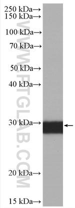 Calretinin Antibody in Western Blot (WB)