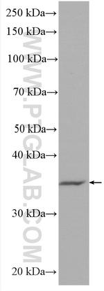 TYMS Antibody in Western Blot (WB)