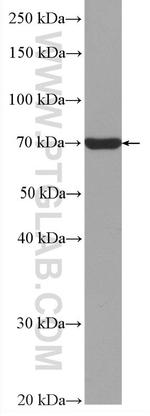 METTL3 Antibody in Western Blot (WB)