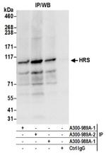 HRS Antibody in Western Blot (WB)