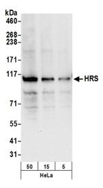 HRS Antibody in Western Blot (WB)