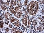 HSD17B10 Antibody in Immunohistochemistry (Paraffin) (IHC (P))