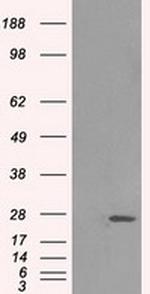 HSD17B10 Antibody in Western Blot (WB)