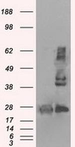 HSD17B10 Antibody in Western Blot (WB)