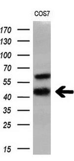 HSD17B2 Antibody in Western Blot (WB)