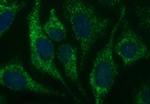 HSD17B4 Antibody in Immunocytochemistry (ICC/IF)