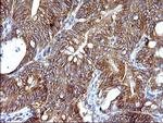 HSD17B4 Antibody in Immunohistochemistry (Paraffin) (IHC (P))