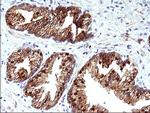 HSD17B4 Antibody in Immunohistochemistry (Paraffin) (IHC (P))