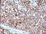 HSD17B4 Antibody in Immunohistochemistry (Paraffin) (IHC (P))