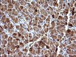 HSD17B4 Antibody in Immunohistochemistry (Paraffin) (IHC (P))