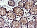 HSD17B4 Antibody in Immunohistochemistry (Paraffin) (IHC (P))