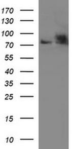 HSD17B4 Antibody in Western Blot (WB)