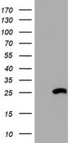 HSD17B8 Antibody in Western Blot (WB)