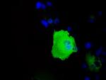 HSPA1A Antibody in Immunocytochemistry (ICC/IF)