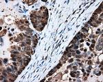 HSPA1A Antibody in Immunohistochemistry (Paraffin) (IHC (P))