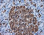 HSPA1A Antibody in Immunohistochemistry (Paraffin) (IHC (P))