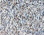 HSPA1A Antibody in Immunohistochemistry (Paraffin) (IHC (P))