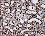 HSPA1A Antibody in Immunohistochemistry (Paraffin) (IHC (P))